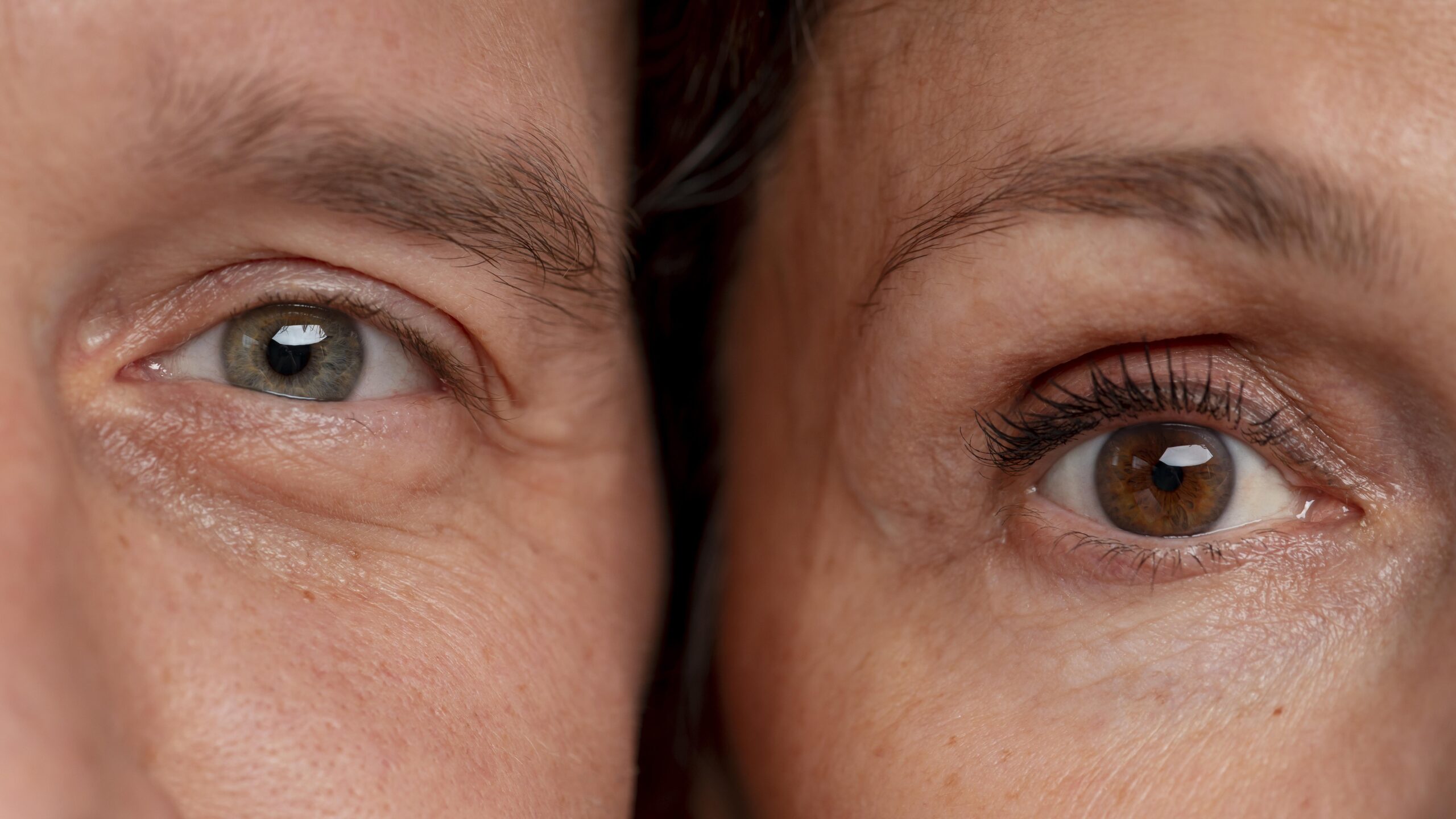 Comment se passe une blépharoplastie en Suisse ?